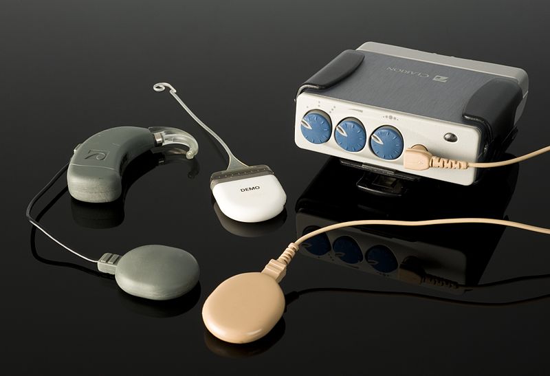 Speech processing cues in children with hearing loss intervened with cochlear implants